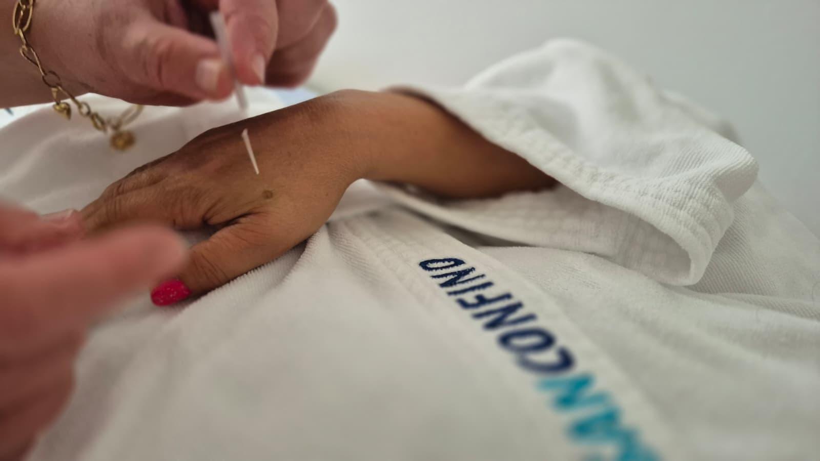Acupuncture
