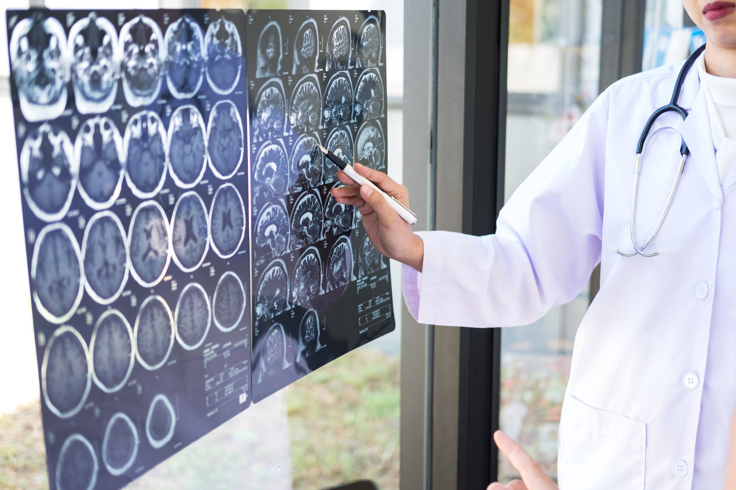 Neurosurgery