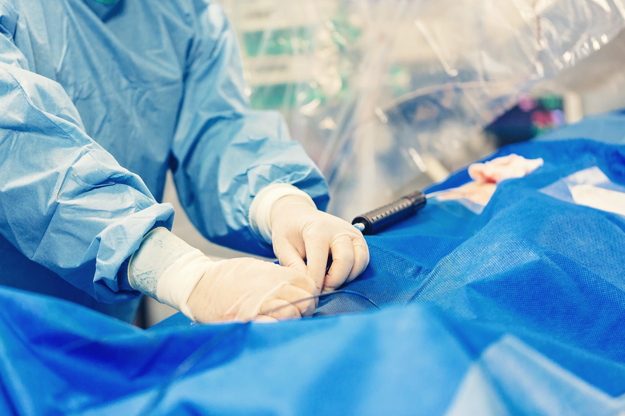 Vascular Surgery