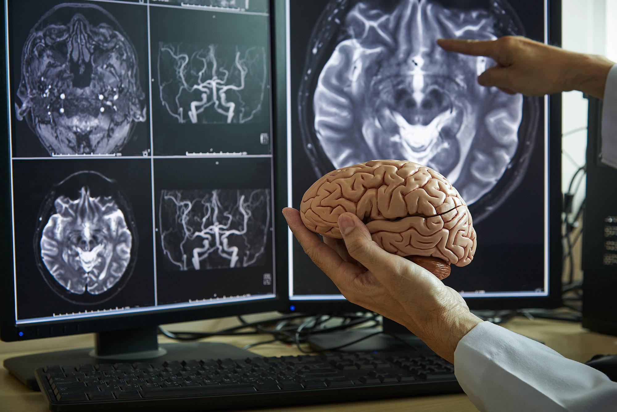 Neurosurgery