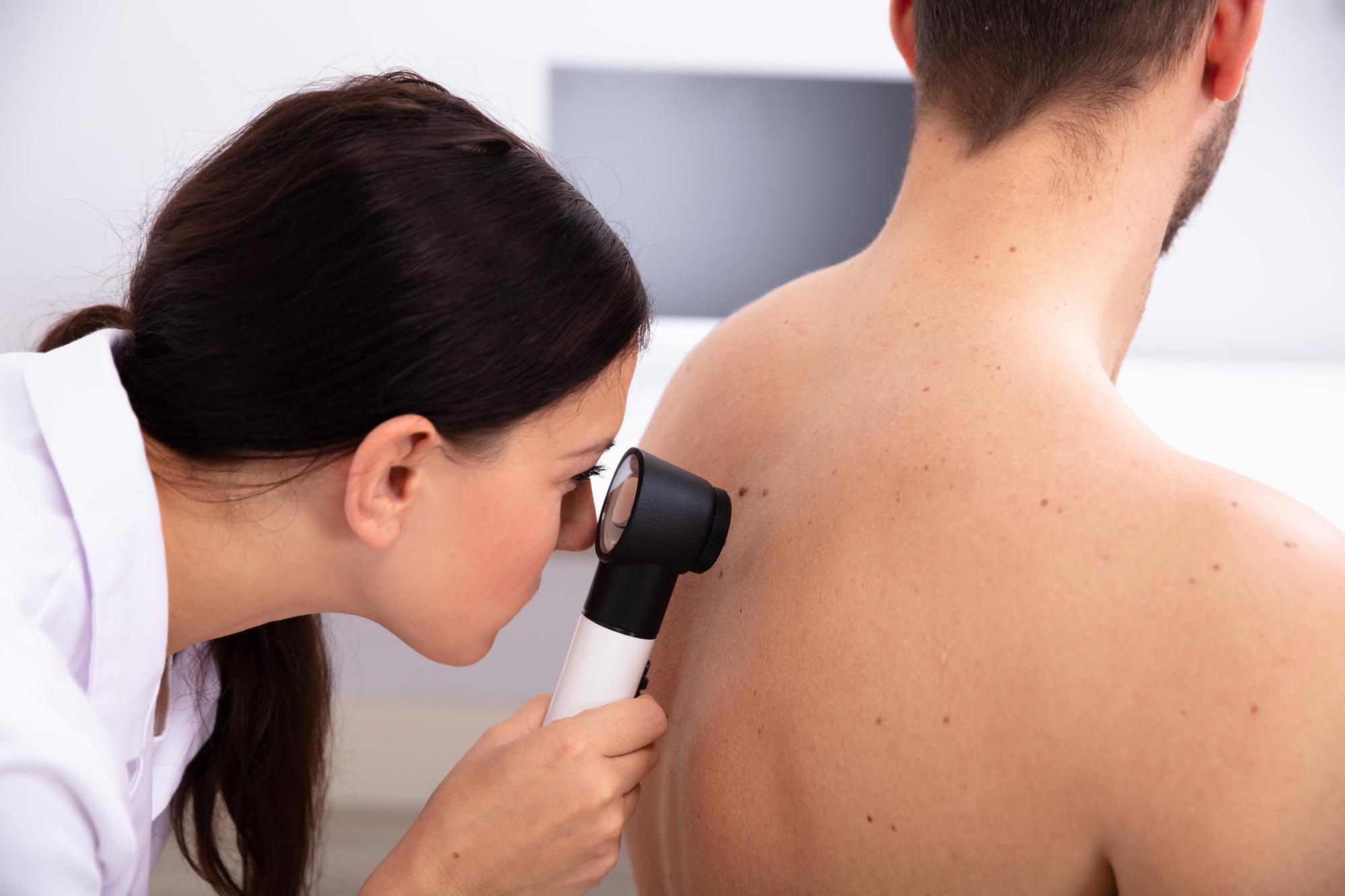 Dermatology