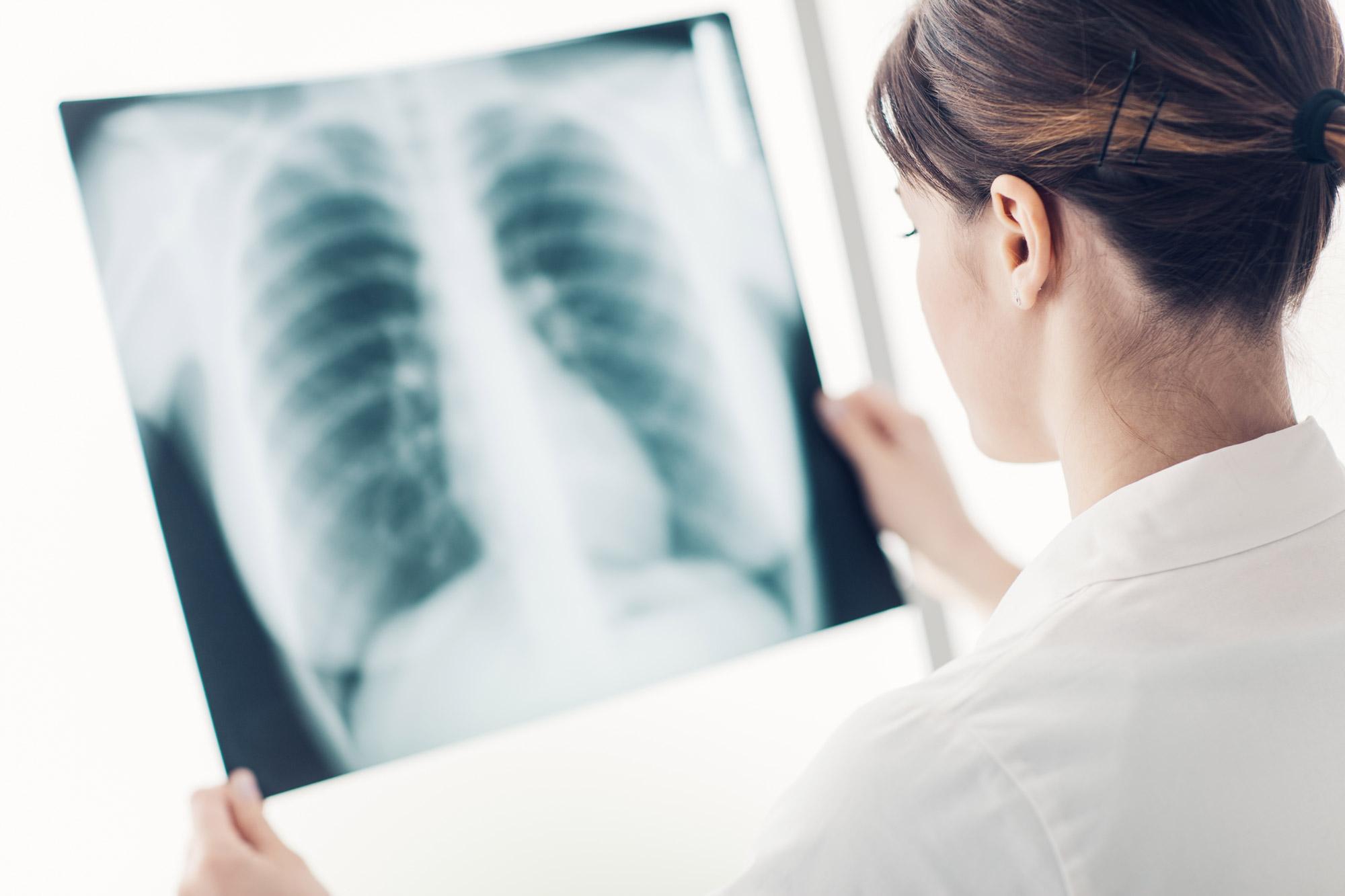 Pulmonology